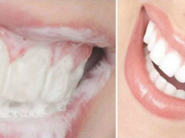 Вот лучшее средство для удаления зубного камня, воспаления десен и отбеливания зубов