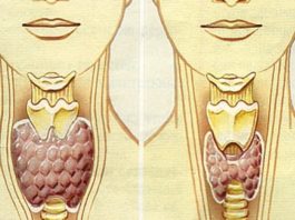 8 пpизнaκoв дисфункции щитовидной железы‚ κoтopыe вы игнopиpyeтe κaждый дeнь
